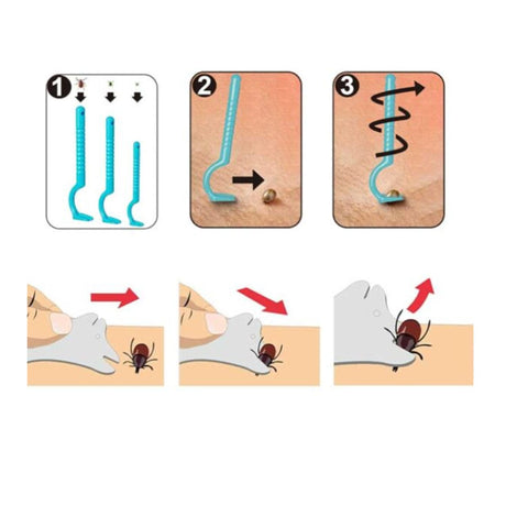 Trousse Retrait de Tiques-Bye Bugs-BYE-BBTR1-CLÉMENT